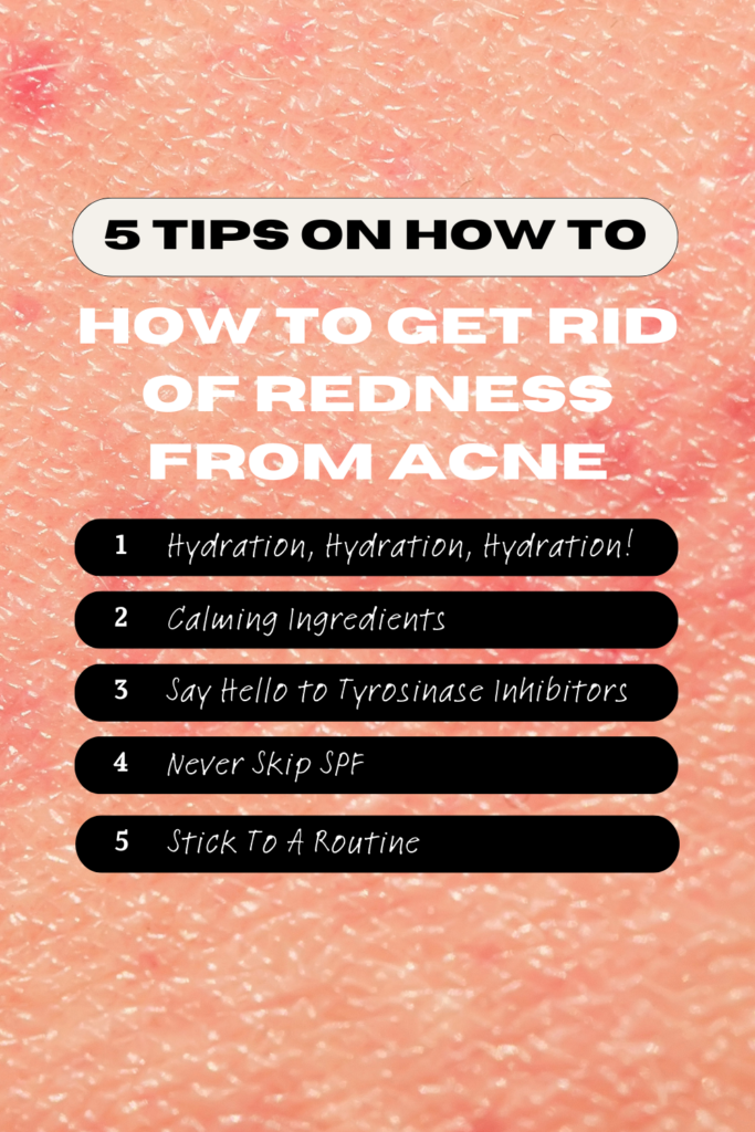 how to get rid of redness from acne